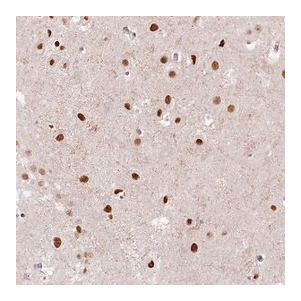 Merck Anti-SORBS2 antibody produced in rabbit