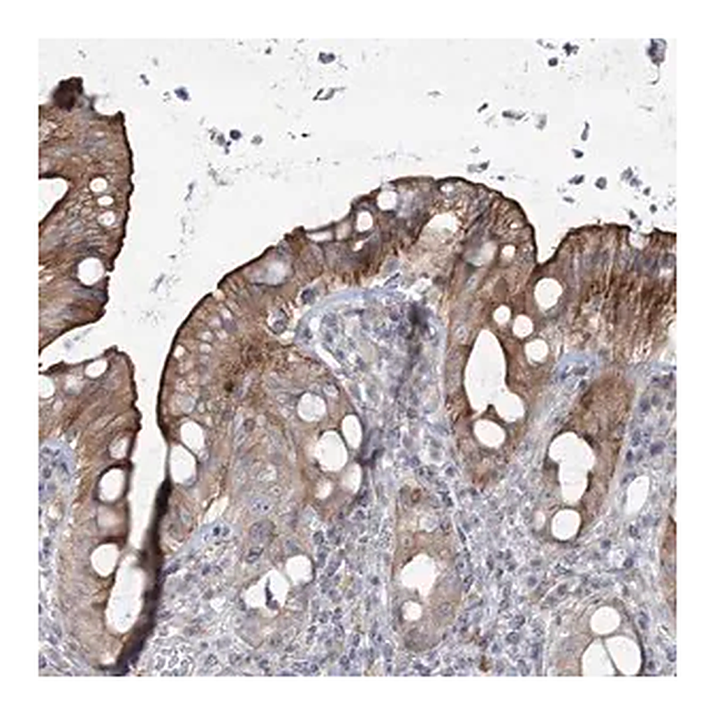 Merck Anti-SCN11A antibody produced in rabbit