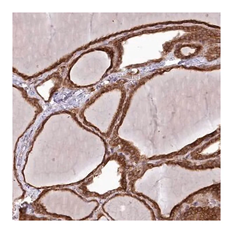 Merck Anti-PPP1R21 antibody produced in rabbit
