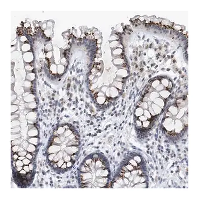 Merck Anti-VWA5B2 antibody produced in rabbit | 캐시바이