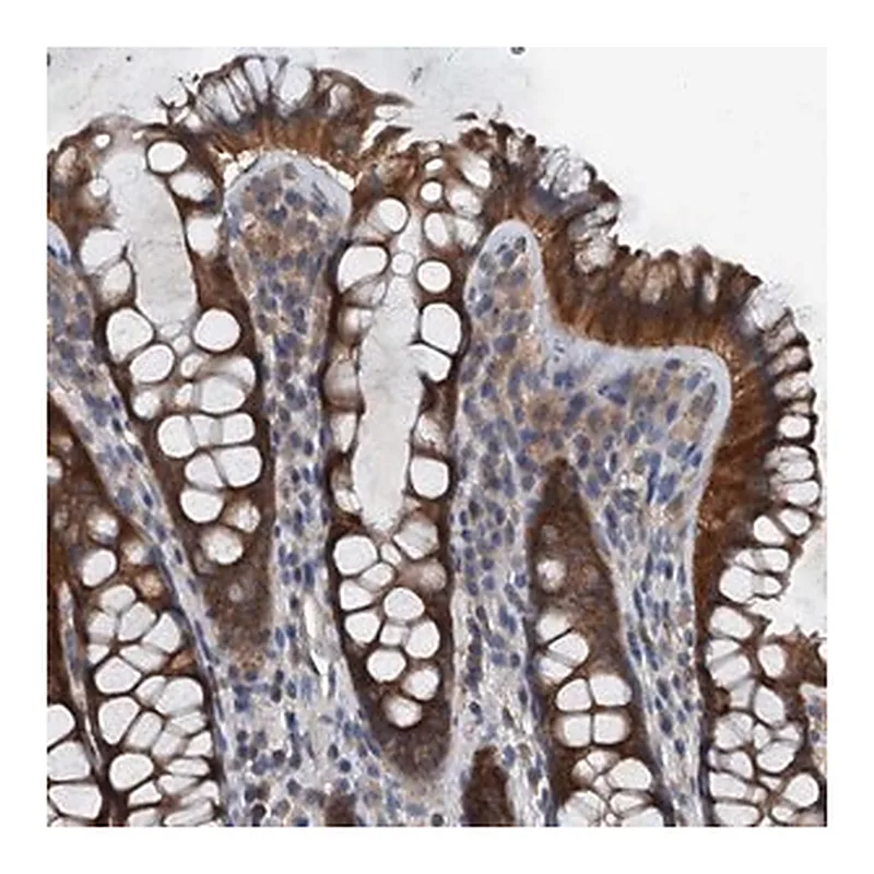 Merck Anti-PDSS1 antibody produced in rabbit
