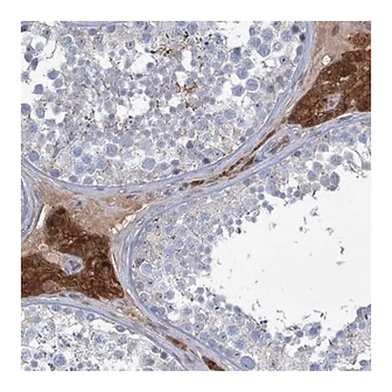 Merck Anti-LPIN1 antibody produced in rabbit