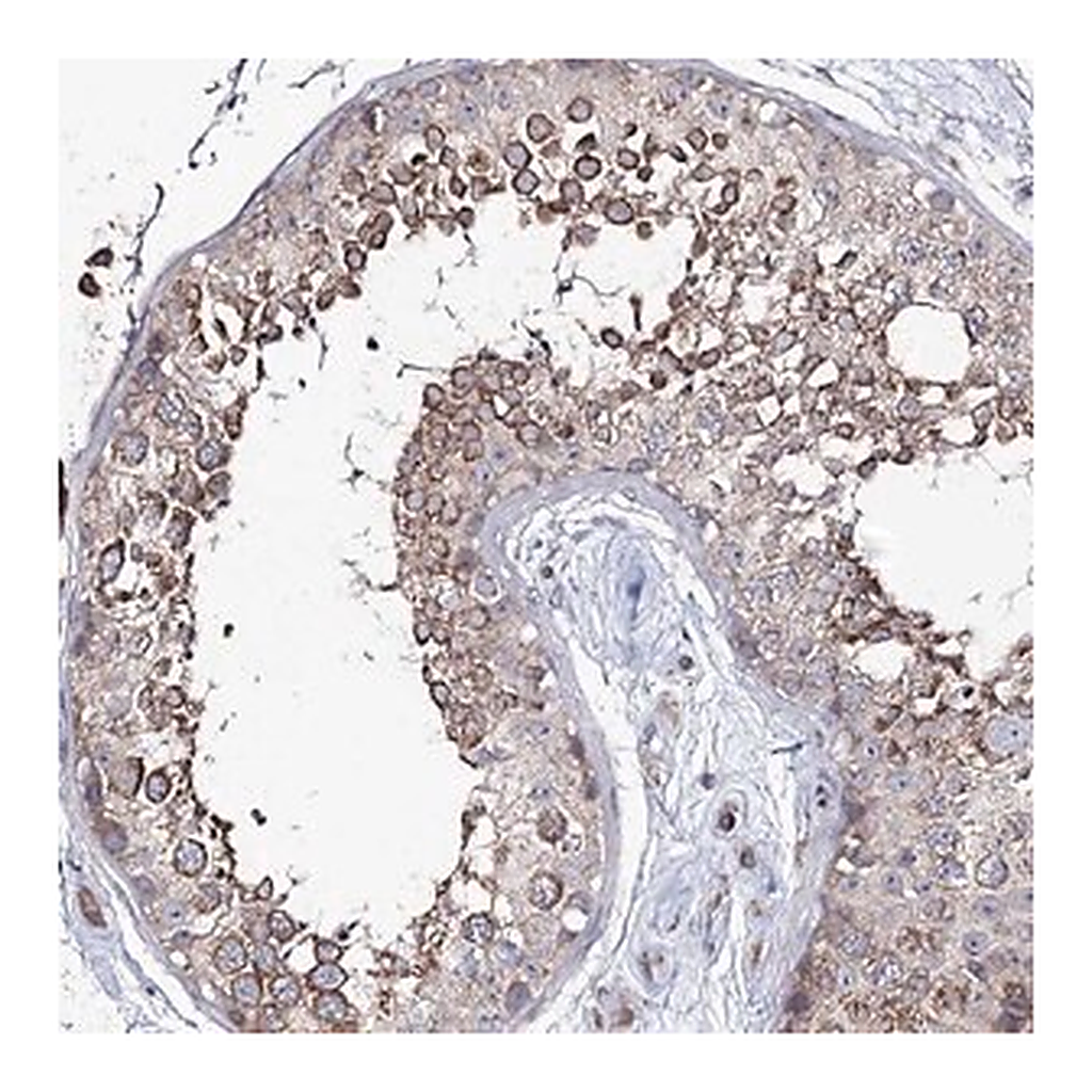 Merck Anti-PUS3 antibody produced in rabbit