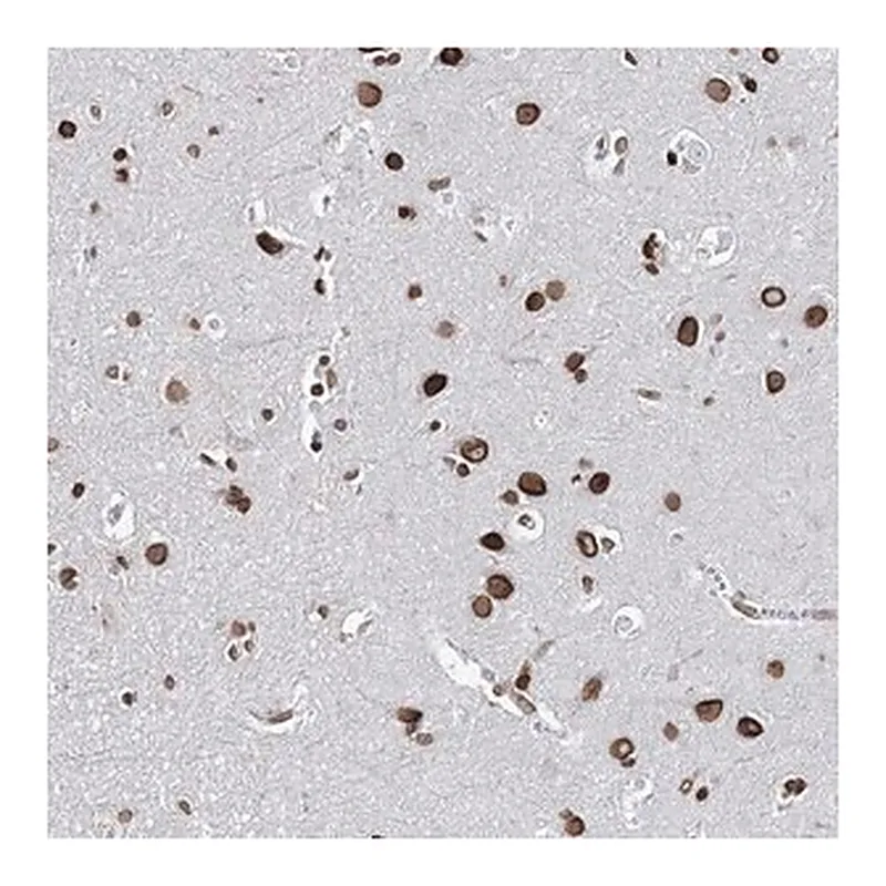 Merck Anti-KIAA0930 antibody produced in rabbit