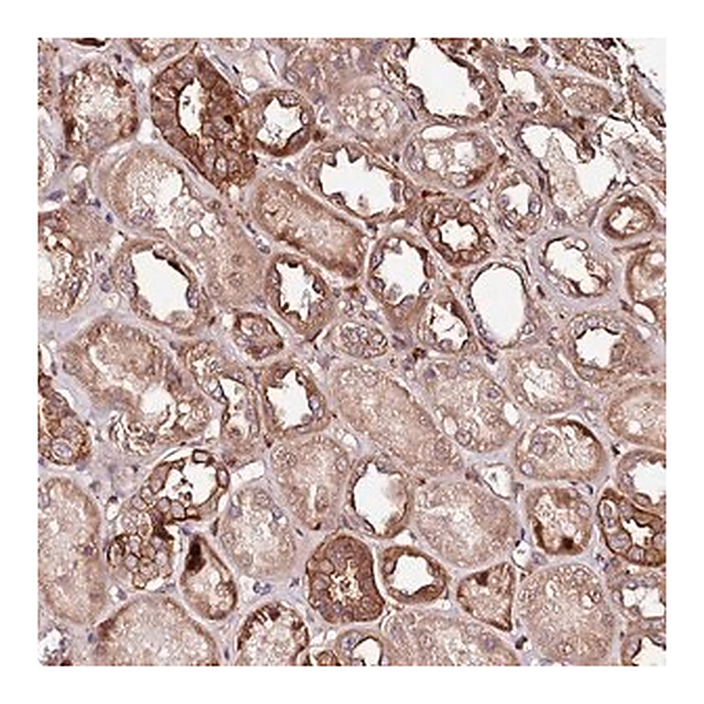 Merck Anti-KIF14 antibody produced in rabbit