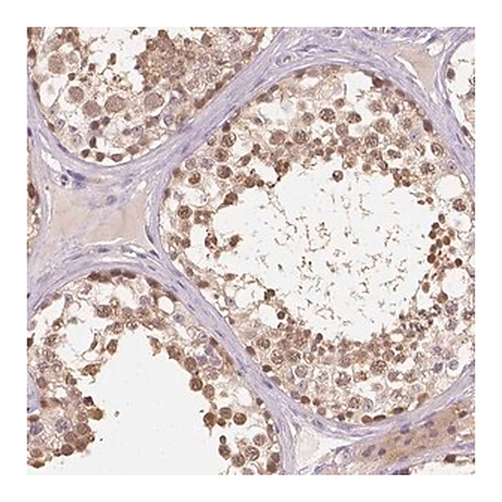 Merck Anti-C10orf67 antibody produced in rabbit