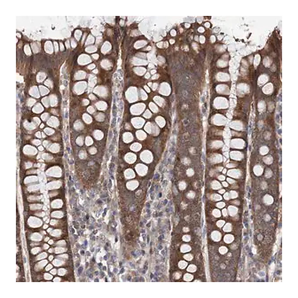 Merck Anti-NAA25 antibody produced in rabbit