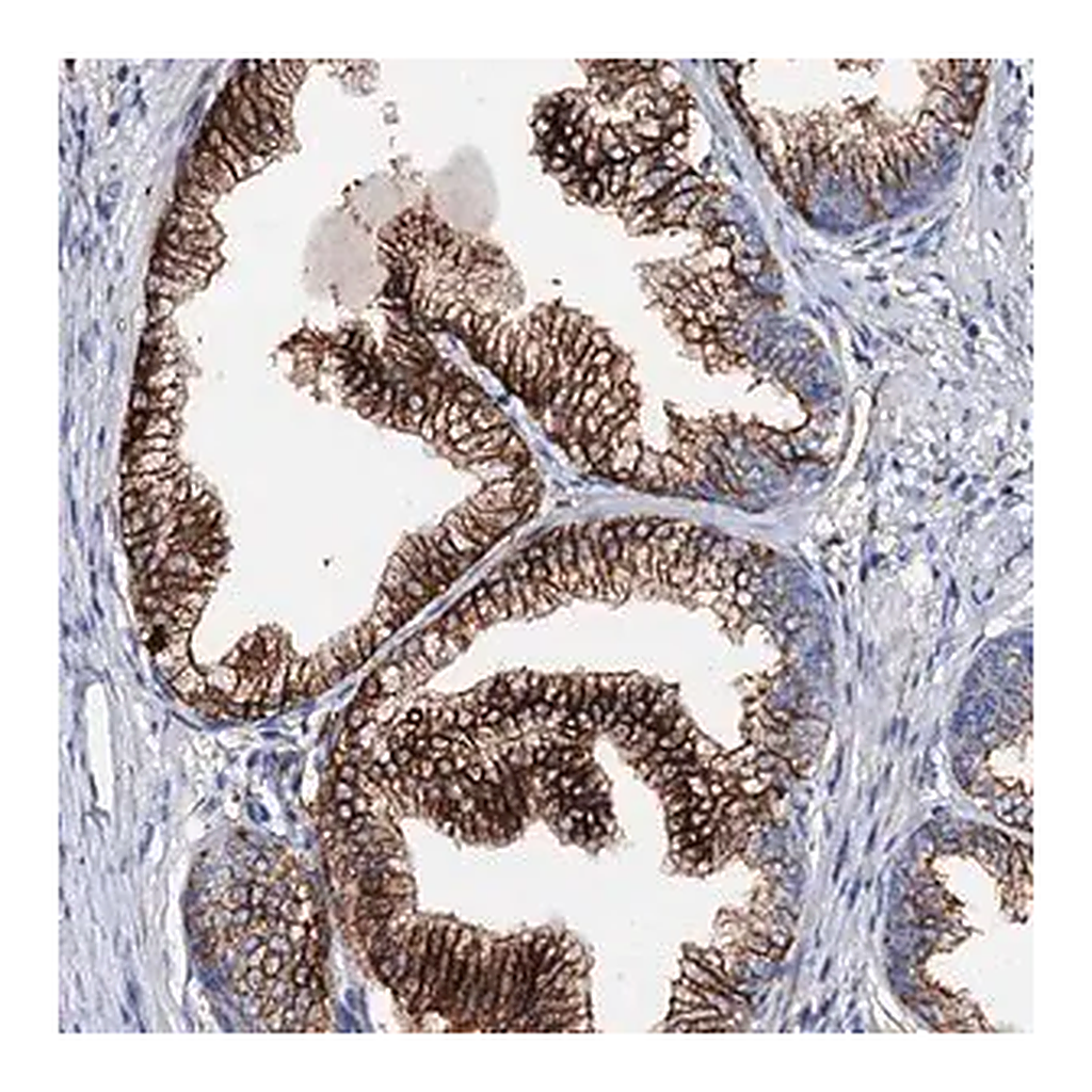Merck Anti-MED13L antibody produced in rabbit