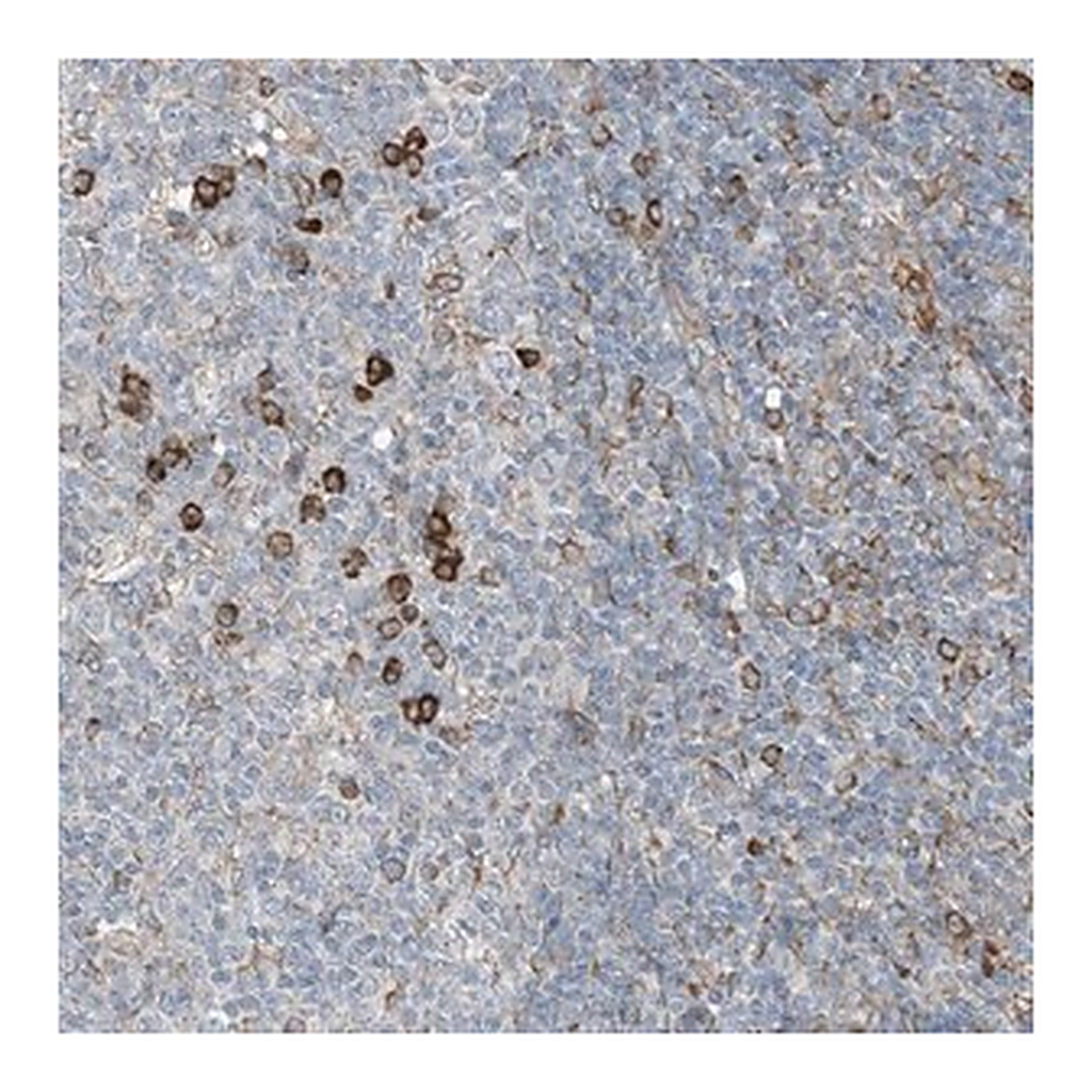 Merck Anti-CERKL antibody produced in rabbit