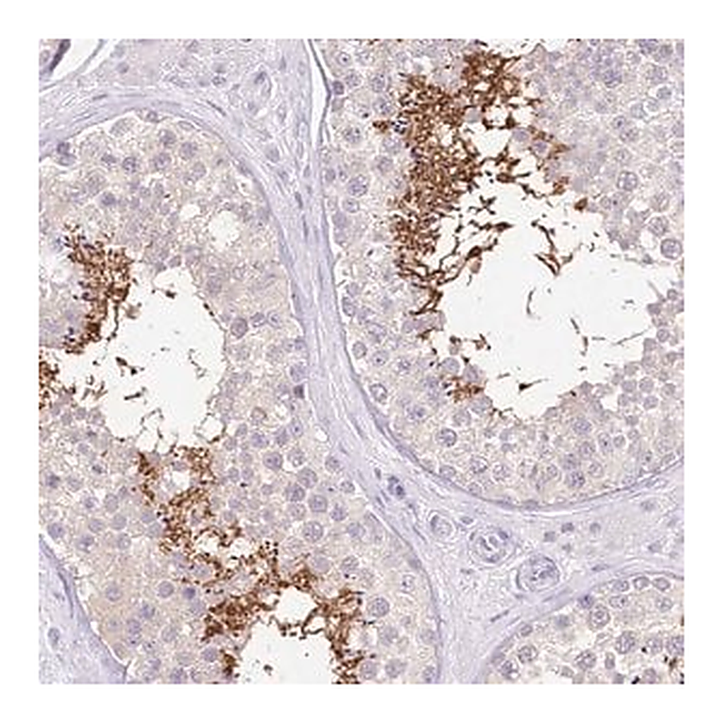 Merck Anti-UBA6 antibody produced in rabbit