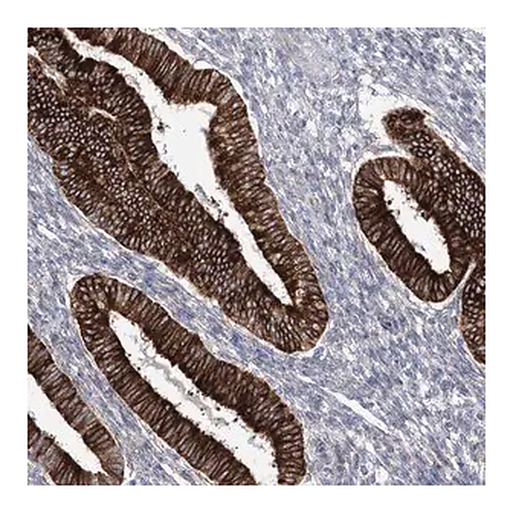 Merck Anti-YTHDC2 antibody produced in rabbit