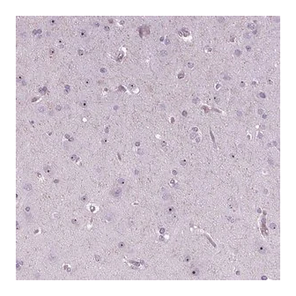 Merck Anti-NOLC1 antibody produced in rabbit