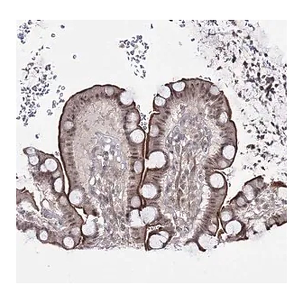 Merck Anti-HOXC11 antibody produced in rabbit