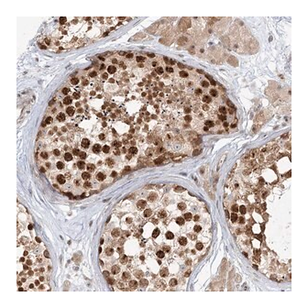 Merck Anti-R3HCC1L antibody produced in rabbit
