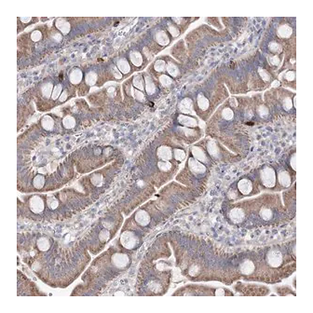 Merck Anti-MTCH2 antibody produced in rabbit