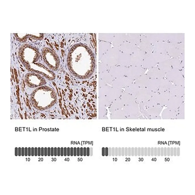Merck Anti-BET1L antibody produced in rabbit