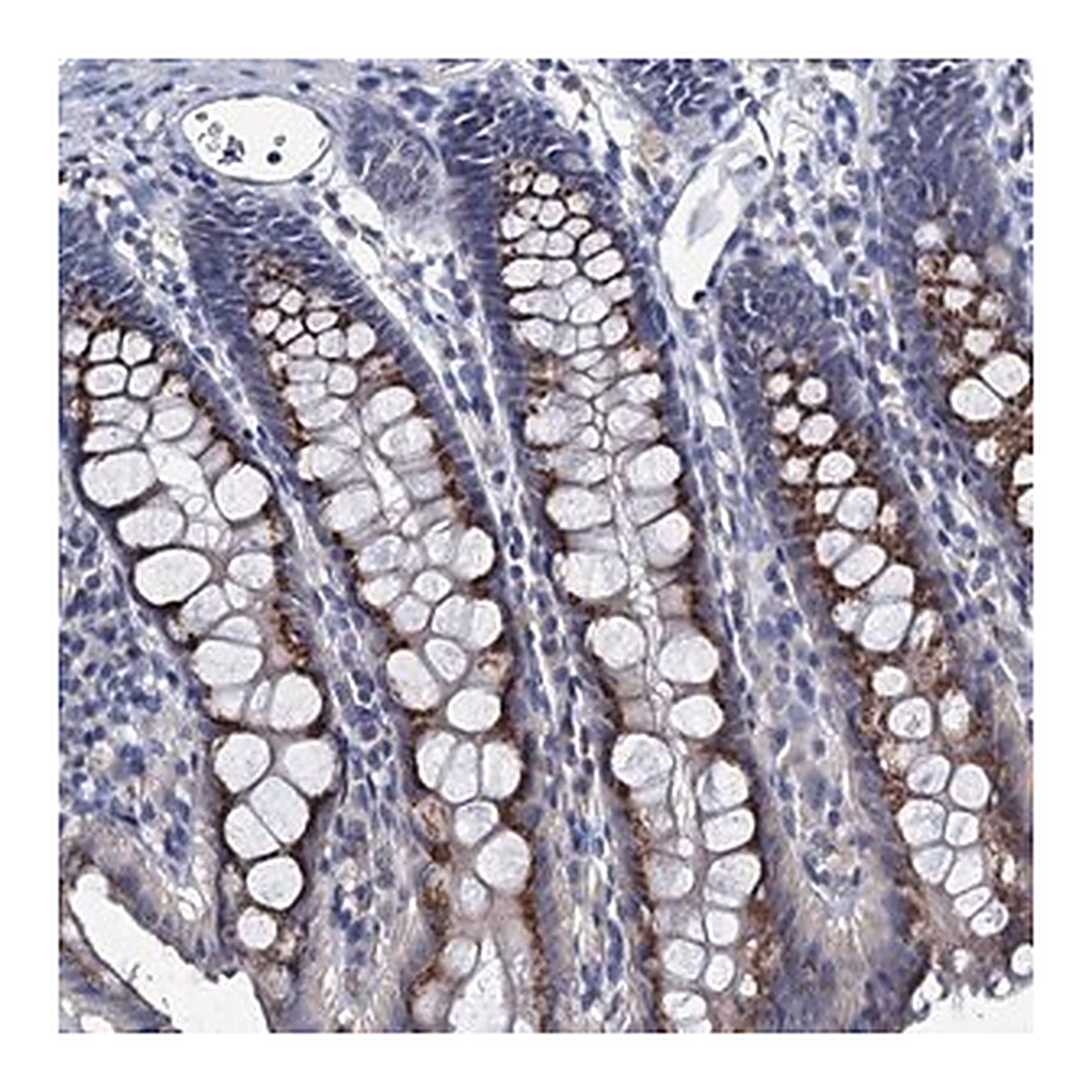 Merck Anti-ANKRD33 antibody produced in rabbit