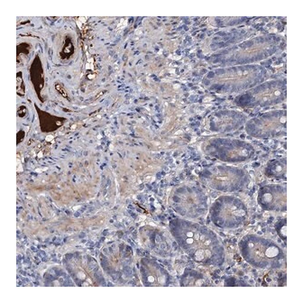 Merck Anti-CHRD antibody produced in rabbit