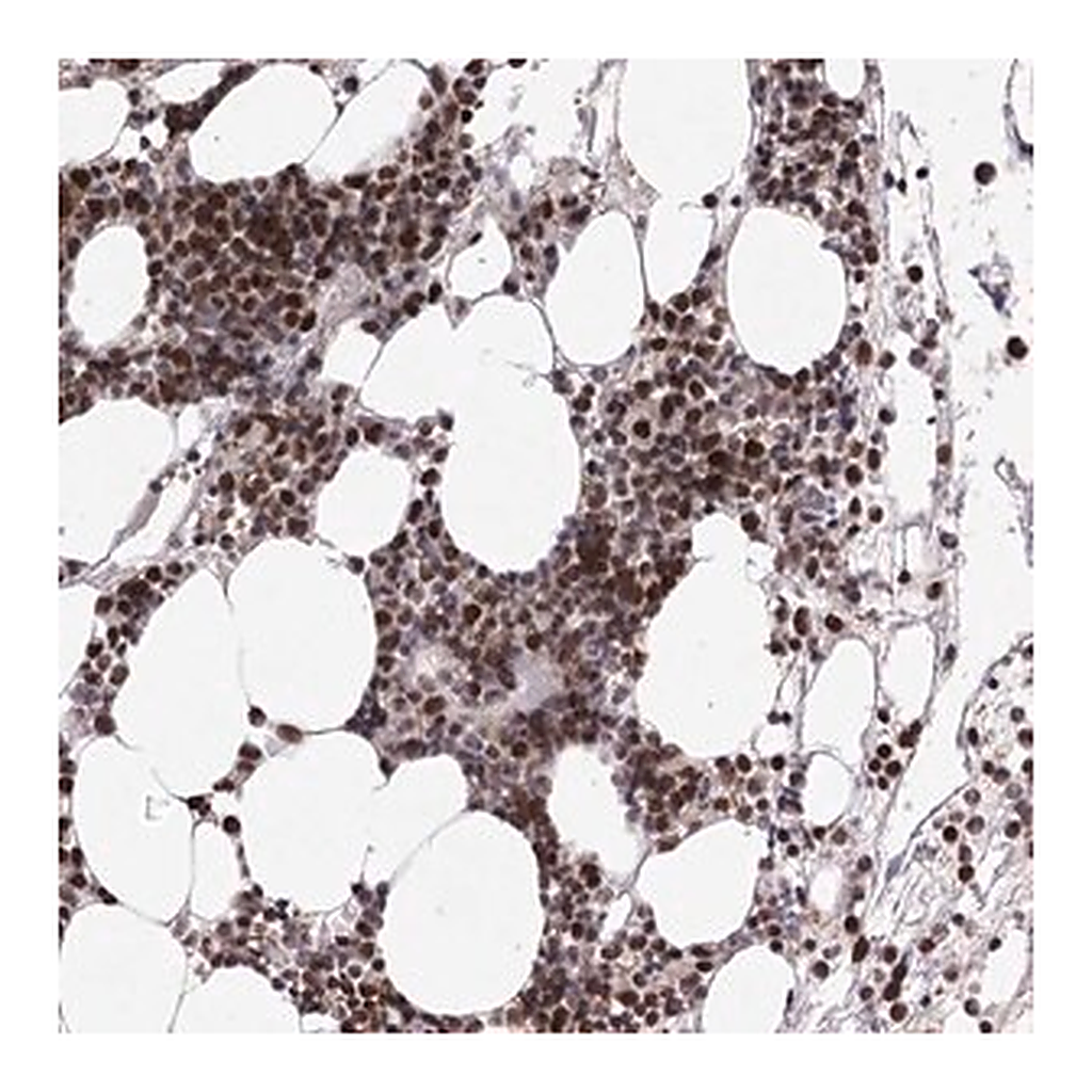 Merck Anti-ZCCHC8 antibody produced in rabbit