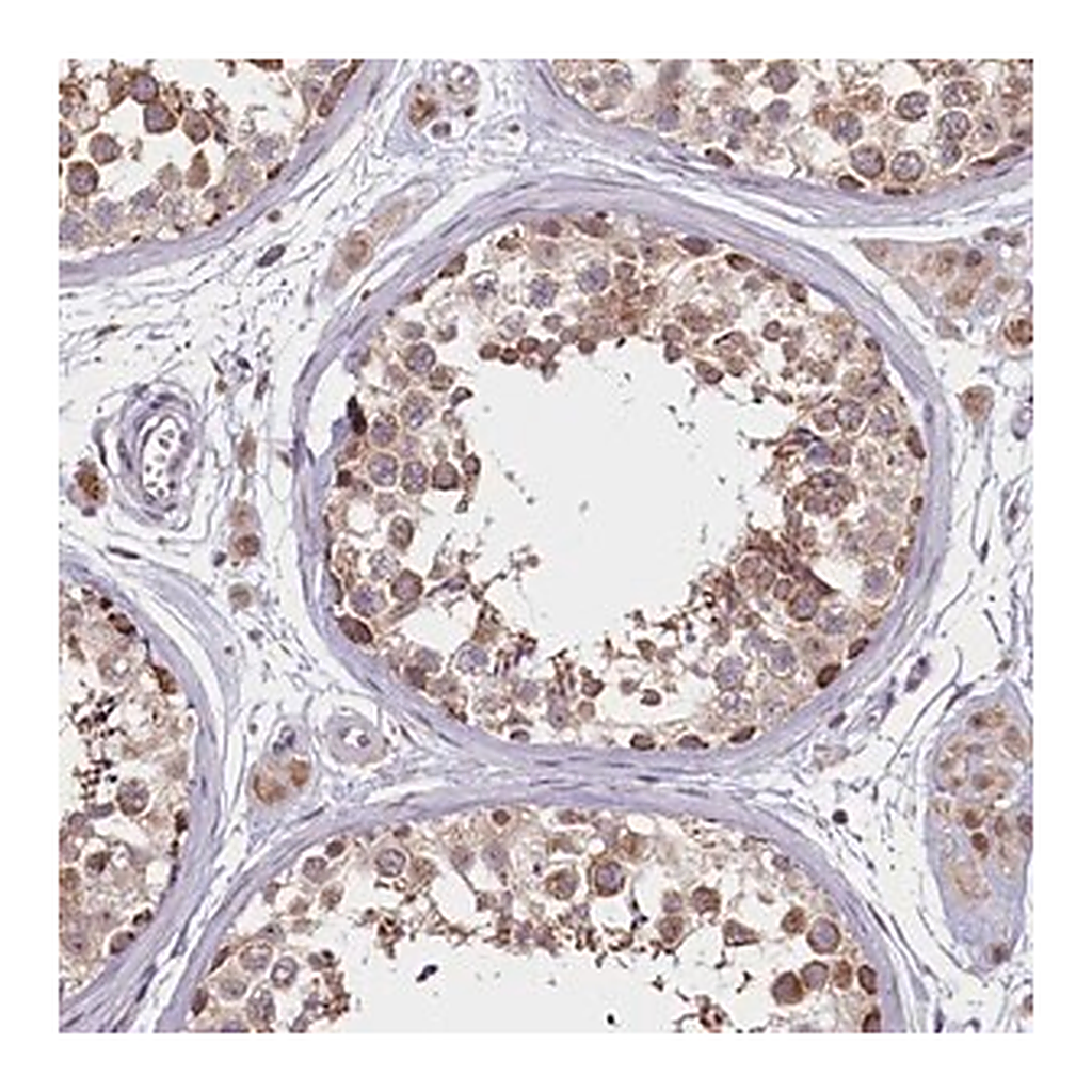 Merck Anti-PDE6D antibody produced in rabbit