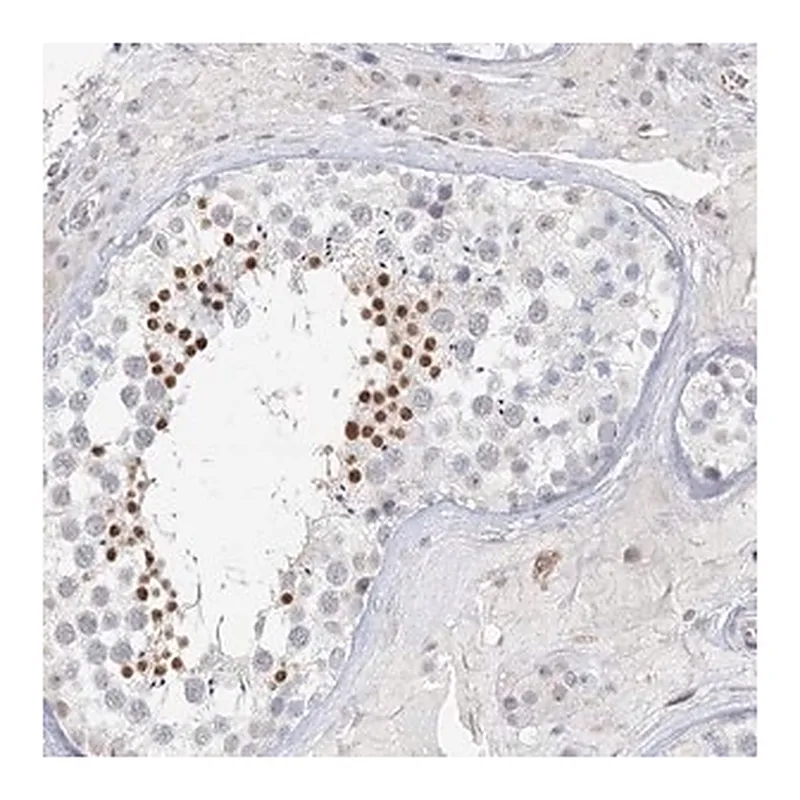 Merck Anti-C6orf222 antibody produced in rabbit