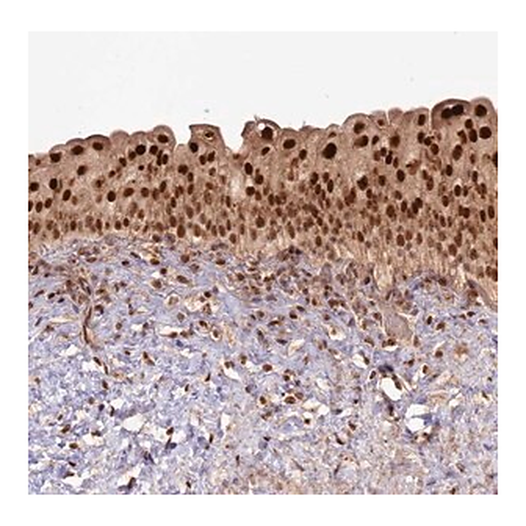 Merck Anti-RRP8 antibody produced in rabbit