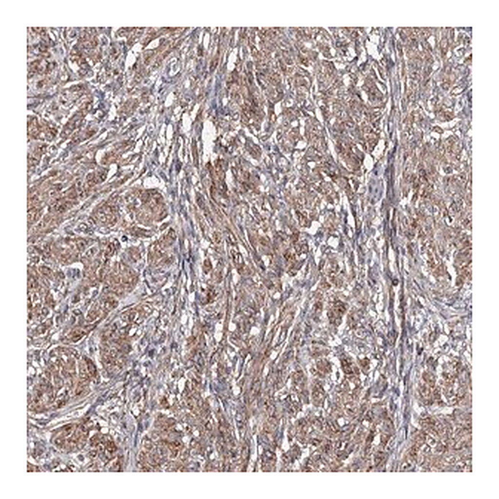 Merck Anti-TMEM218 antibody produced in rabbit