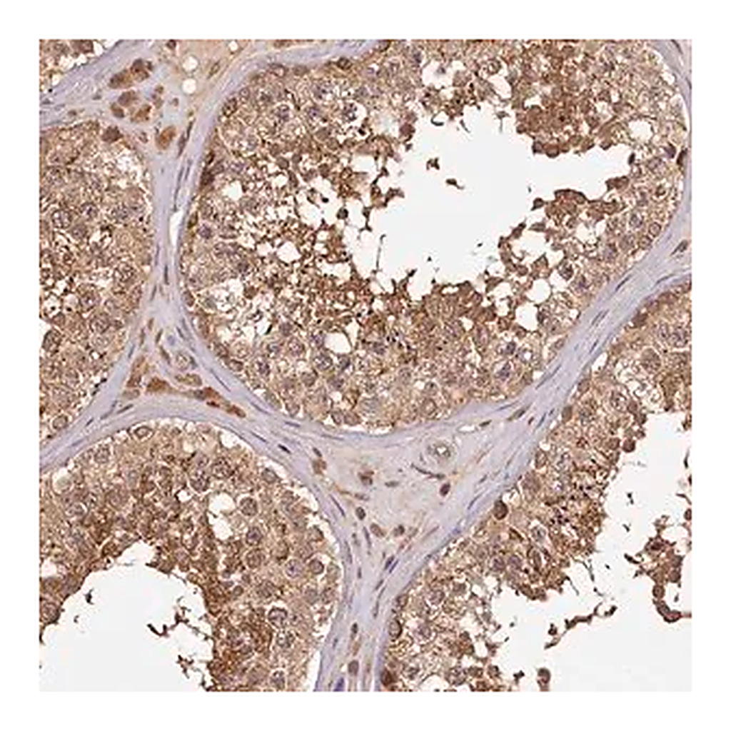 Merck Anti-TTC12 antibody produced in rabbit
