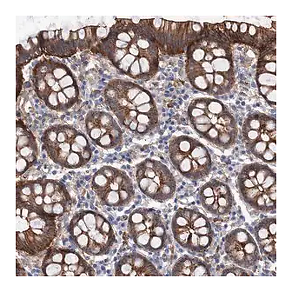 Merck Anti-TMTC3 antibody produced in rabbit