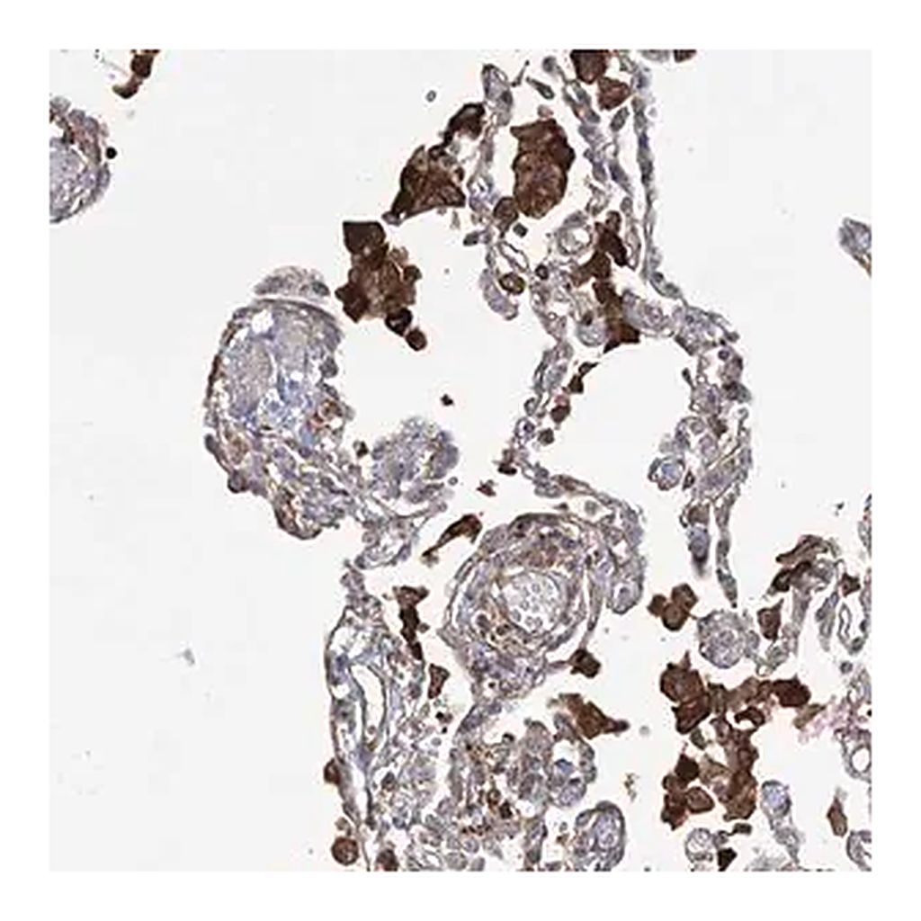 Merck Anti-OTUD1 antibody produced in rabbit