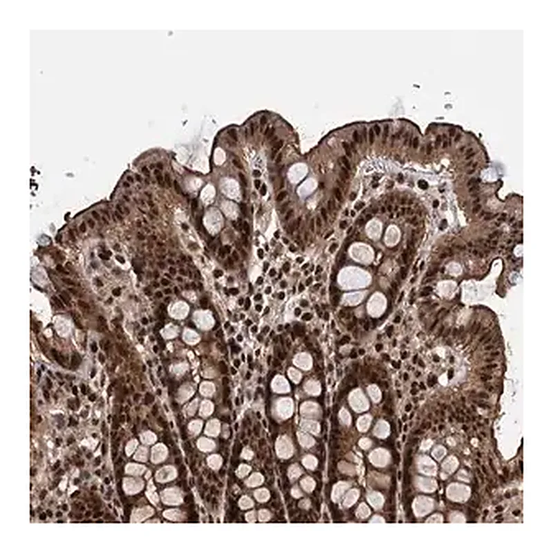 Merck Anti-ANKRD49 antibody produced in rabbit