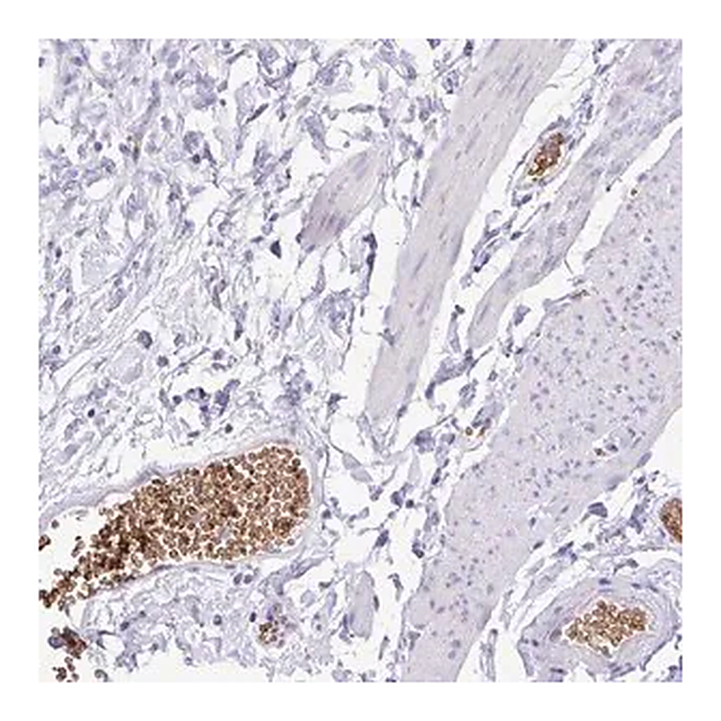 Merck Anti-EPB42 antibody produced in rabbit