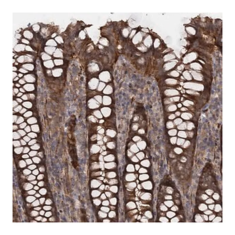 Merck Anti-ATP8B4 antibody produced in rabbit