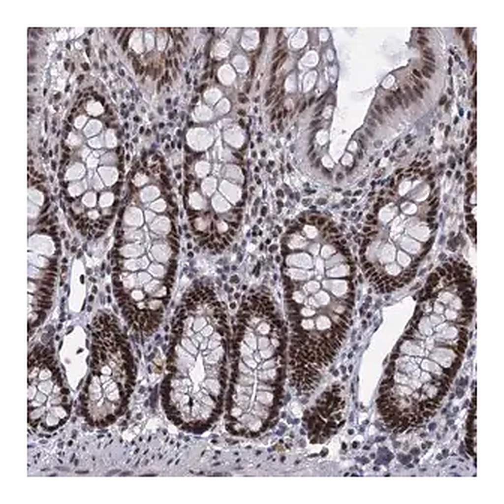 Merck Anti-RPRD1A antibody produced in rabbit