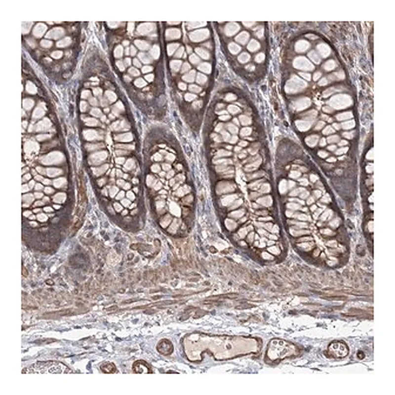 Merck Anti-LARS2 antibody produced in rabbit