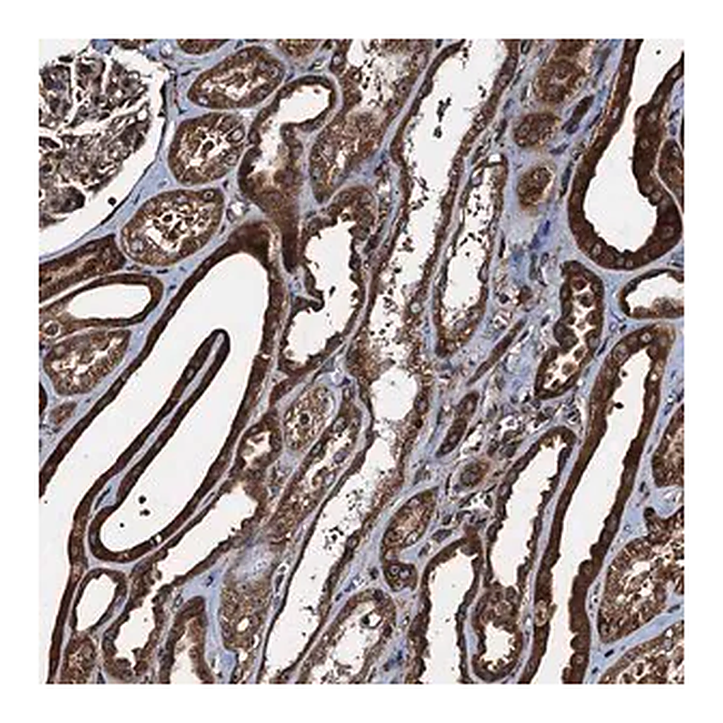 Merck Anti-ATP2C1 antibody produced in rabbit
