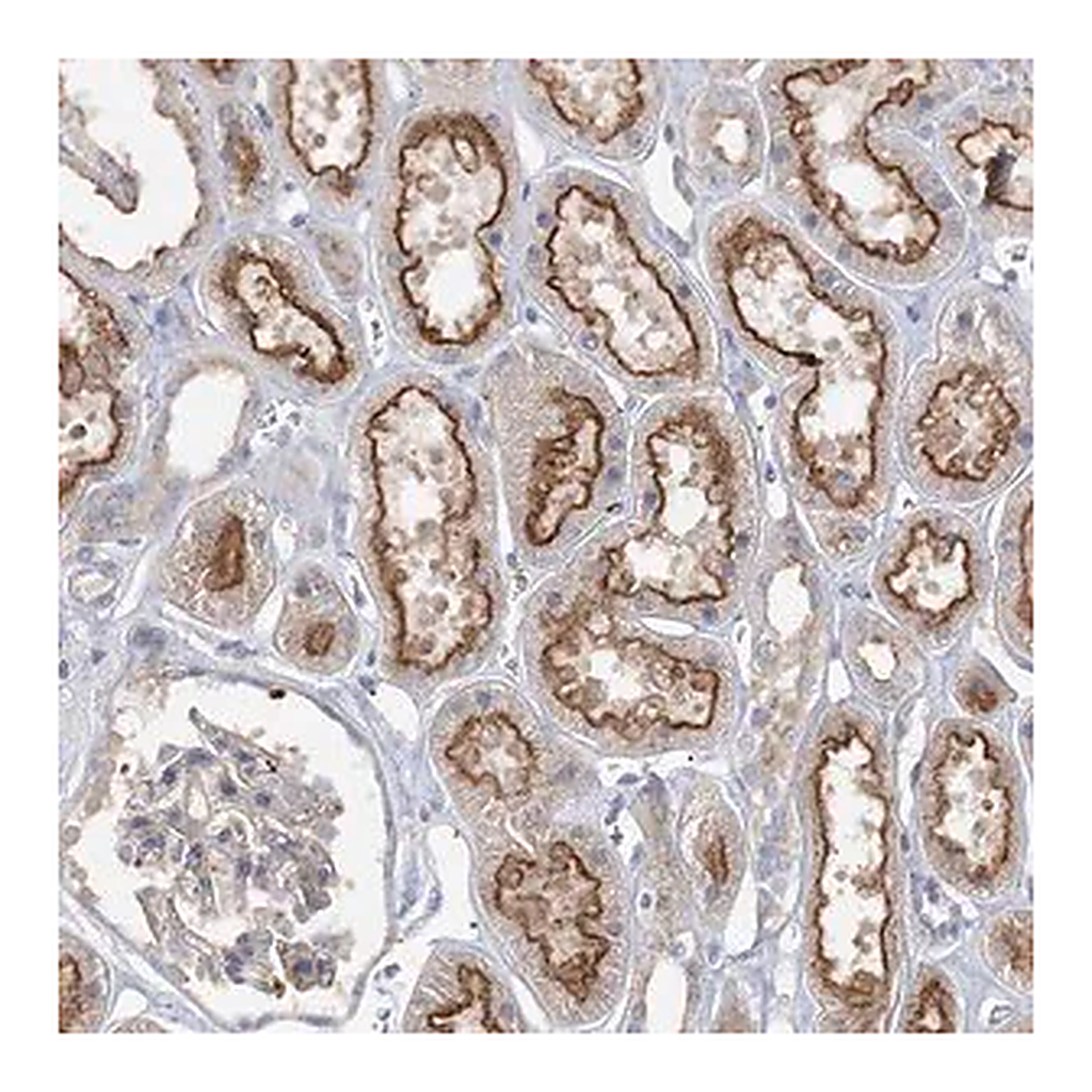 Merck Anti-ADCK2 antibody produced in rabbit