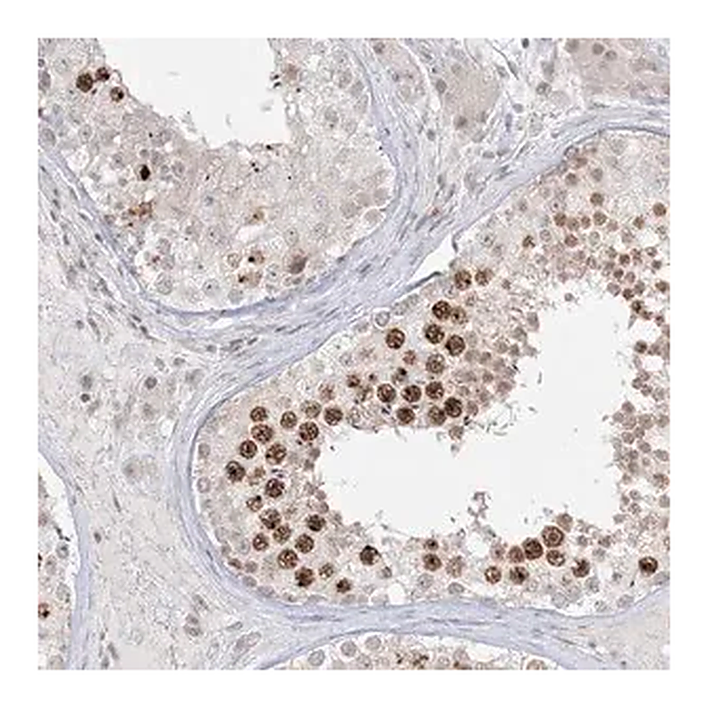 Merck Anti-PTK6 antibody produced in rabbit