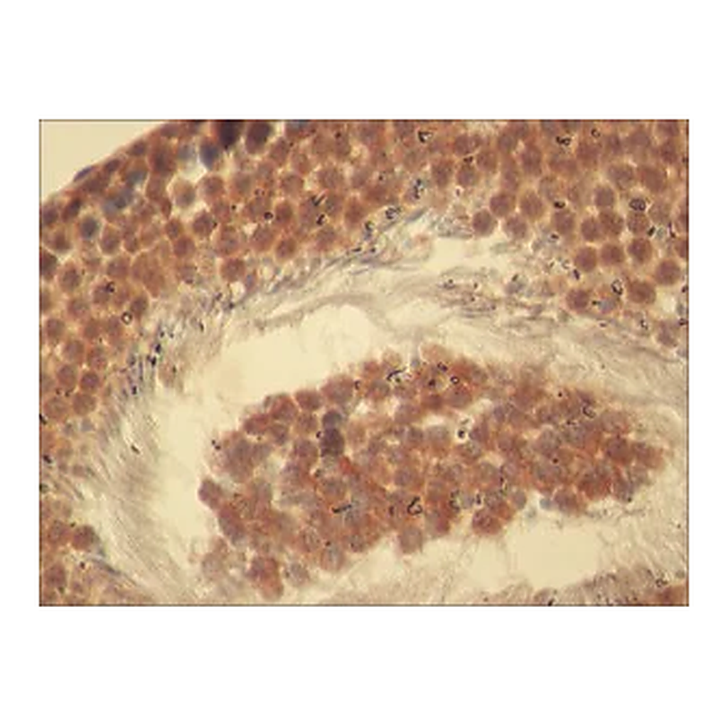 Merck Anti-Rictor antibody produced in rabbit