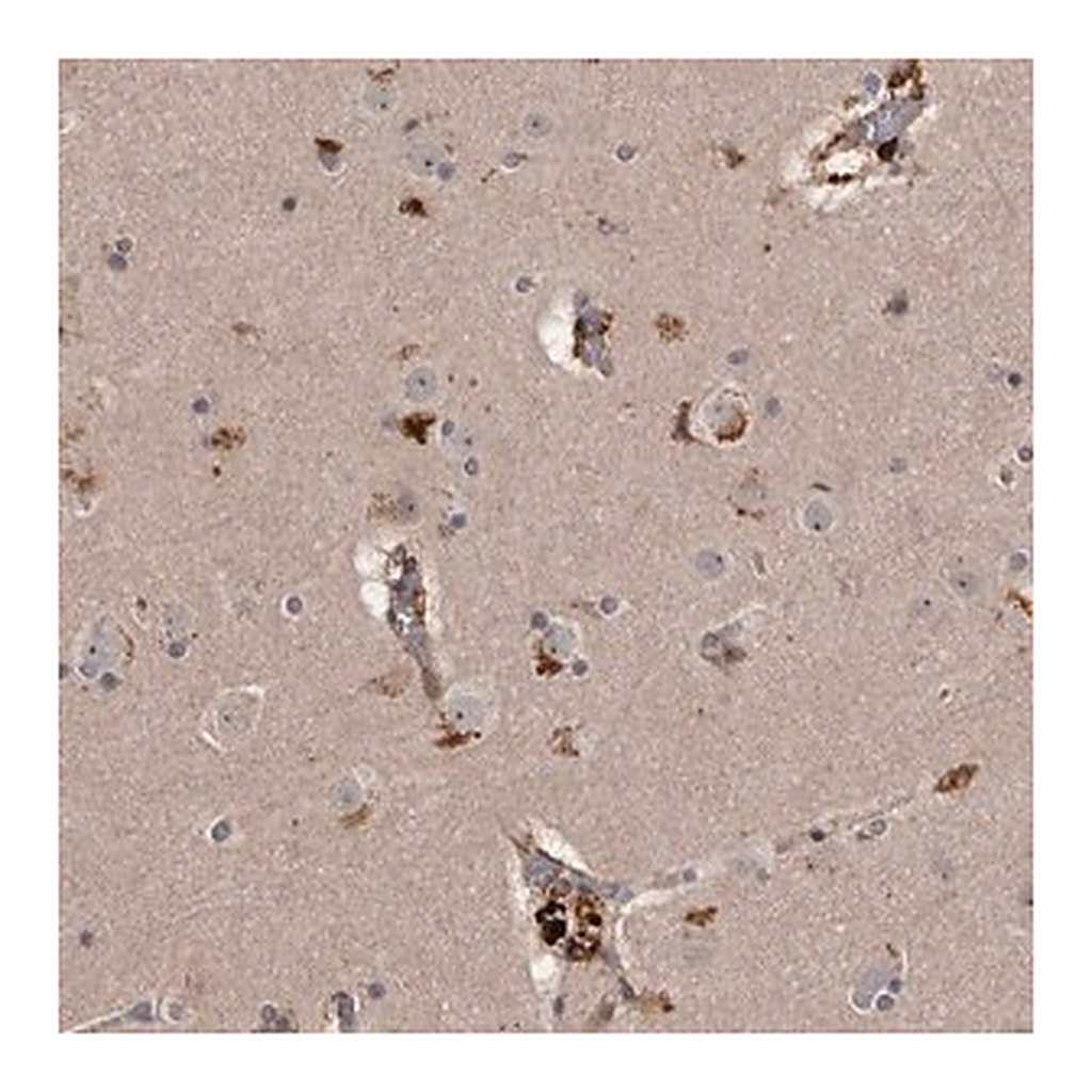 Merck Anti-CYP1B1 antibody produced in rabbit