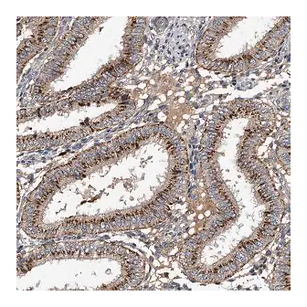 Merck Anti-PI15 antibody produced in rabbit