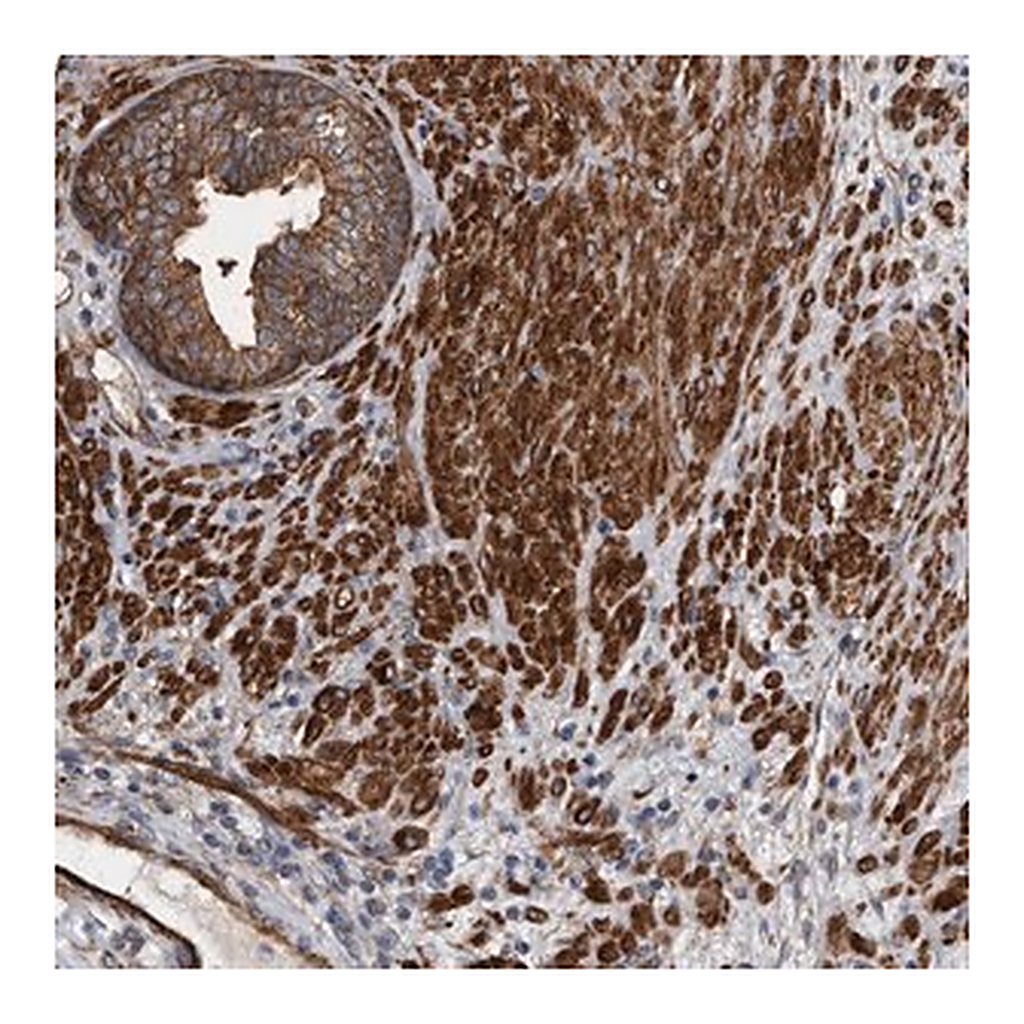 Merck Anti-KCTD20 antibody produced in rabbit