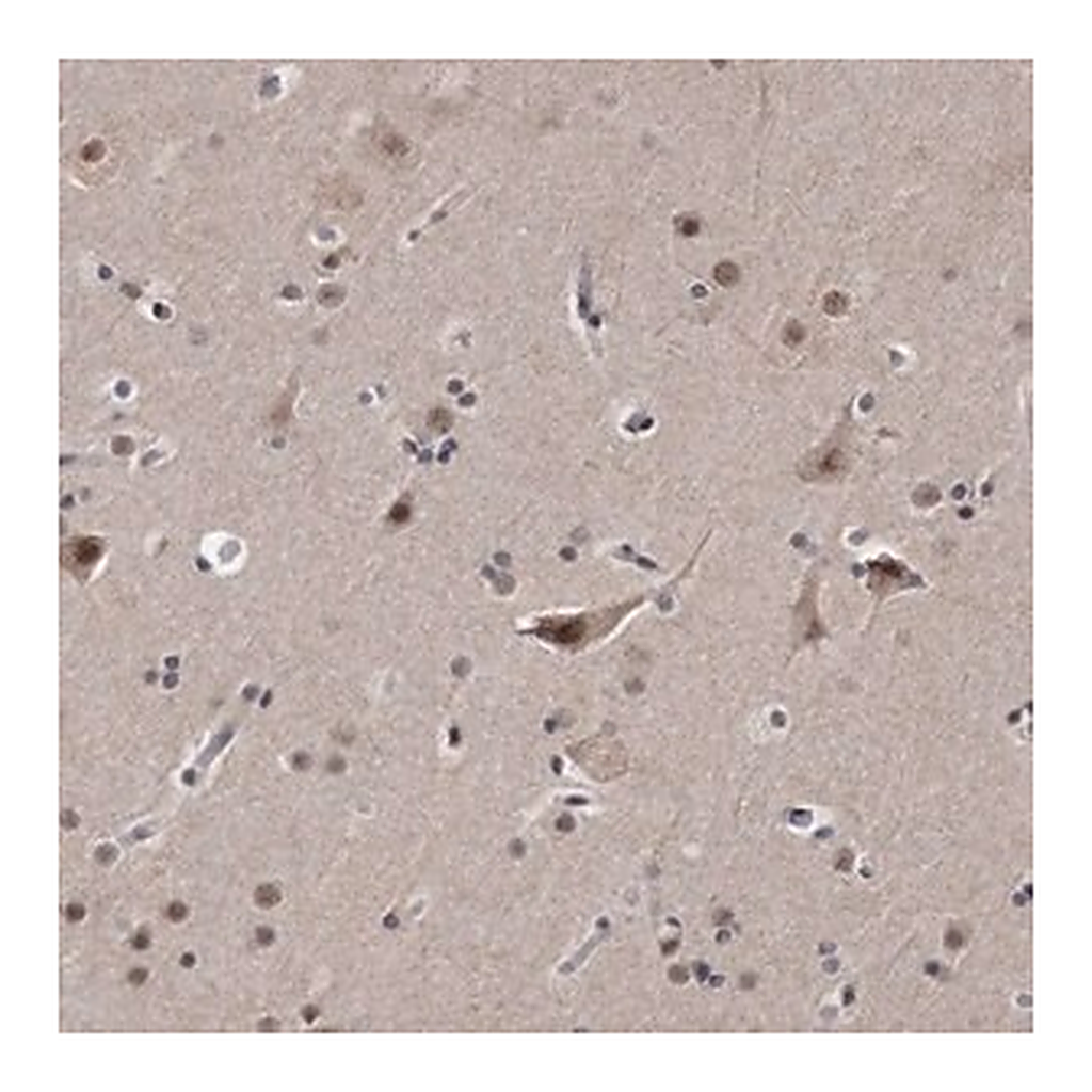 Merck Anti-KLHDC3 antibody produced in rabbit