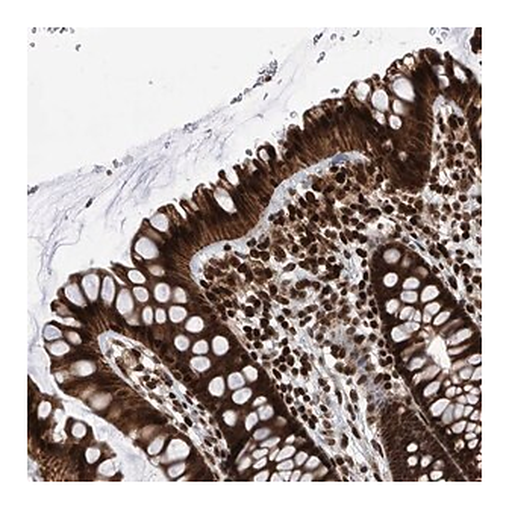 Merck Anti-PAK1IP1 antibody produced in rabbit