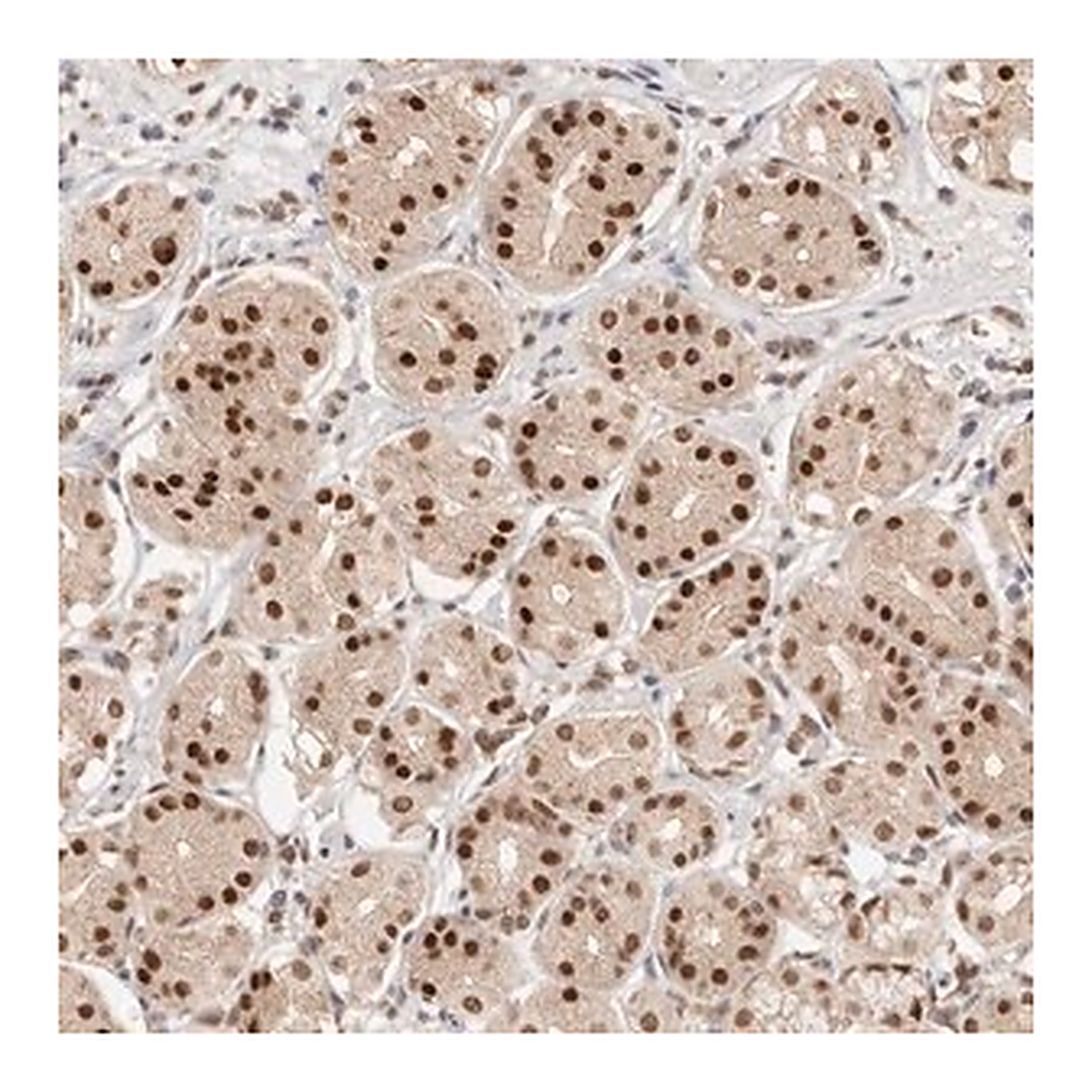 Merck Anti-RFC3 antibody produced in rabbit