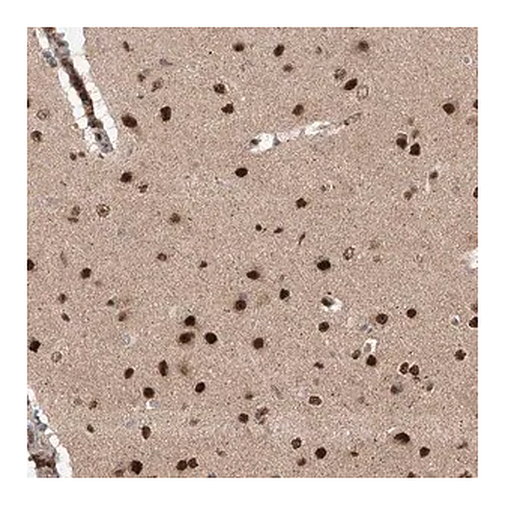 Merck Anti-ZNF280D antibody produced in rabbit