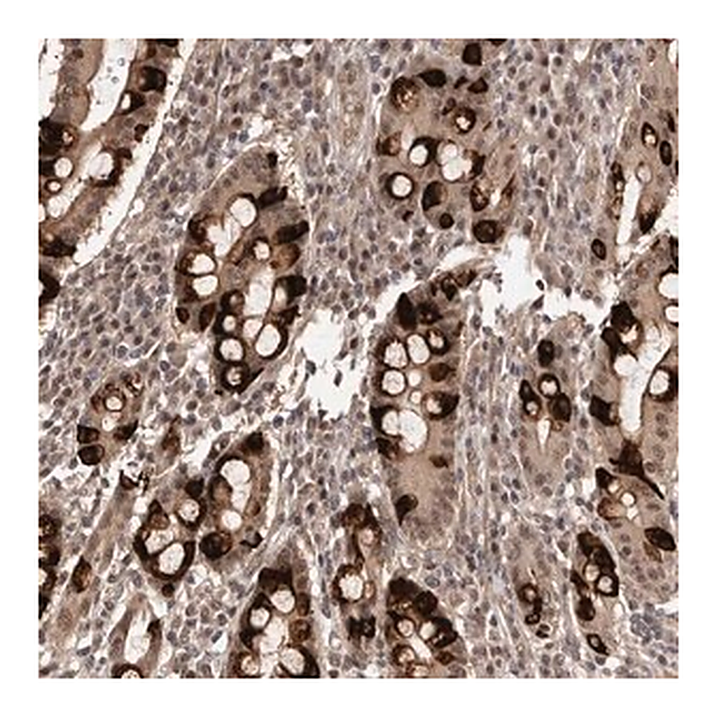 Merck Anti-TBC1D22B antibody produced in rabbit