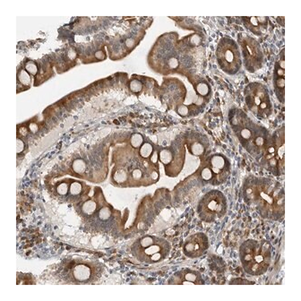 Merck Anti-ALPK2 antibody produced in rabbit