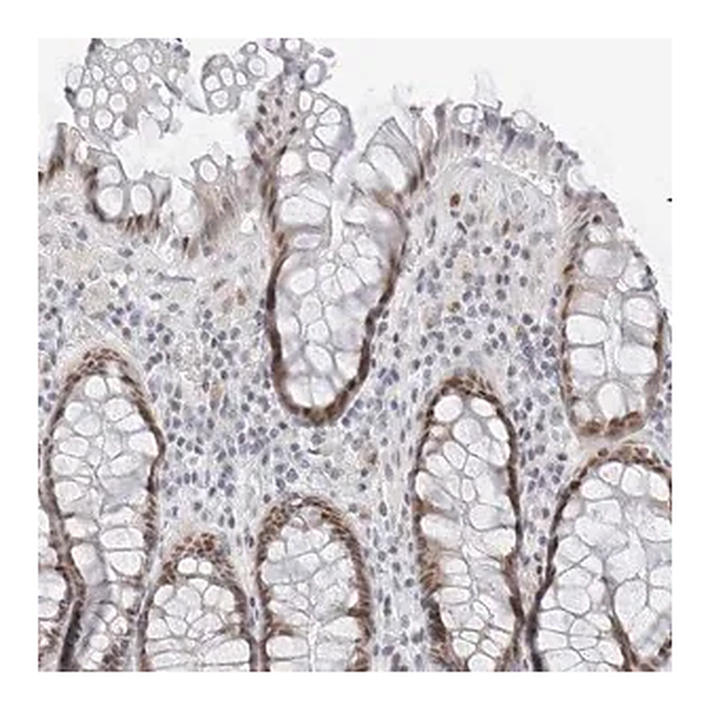 Merck Anti-METTL11B antibody produced in rabbit