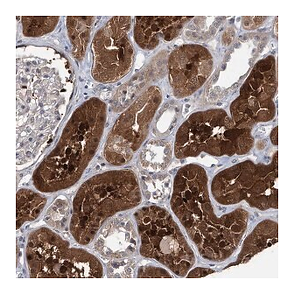 Merck Anti-AKNAD1 antibody produced in rabbit